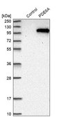 Anti-PDE6A antibody produced in rabbit Prestige Antibodies® Powered by Atlas Antibodies, affinity isolated antibody, buffered aqueous glycerol solution