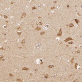 Anti-APP antibody produced in rabbit Prestige Antibodies® Powered by Atlas Antibodies, affinity isolated antibody, buffered aqueous glycerol solution