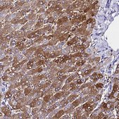 Anti-FTL antibody produced in rabbit Prestige Antibodies® Powered by Atlas Antibodies, affinity isolated antibody, buffered aqueous glycerol solution