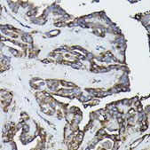 Anti- Calreticulin antibody produced in rabbit