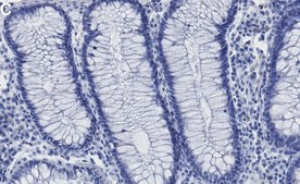 Anti-HMGA1 Antibody, clone 1F20 ZooMAb® Rabbit Monoclonal recombinant, expressed in HEK 293 cells