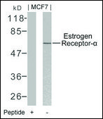 Anti-ESR1 (Ab-106) antibody produced in rabbit affinity isolated antibody