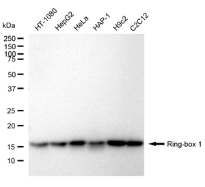 Anti Ring-Box 1 Antibody, clone 24GB950, Rabbit Monoclonal clone 24GB950, recombinant rabbit monoclonal, expressed in HEK293 cells