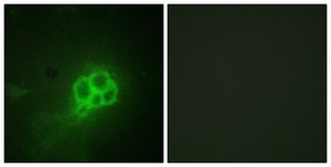 Anti-Tryptophan Hydroxylase antibody produced in rabbit affinity isolated antibody