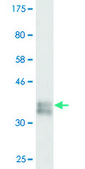 单克隆抗-COL1A1 小鼠抗 clone 3G3, purified immunoglobulin, buffered aqueous solution