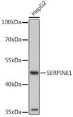 Anti-SERPINE1 antibody produced in rabbit