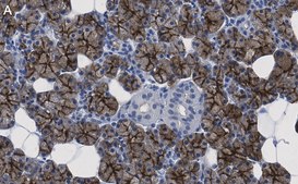 Anti-Aquaporin 5 Antibody, clone 3H17 ZooMAb® Rabbit Monoclonal recombinant, expressed in HEK 293 cells