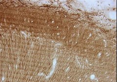 抗-MAP2A抗体，AP20 ascites fluid, clone AP20, Chemicon®