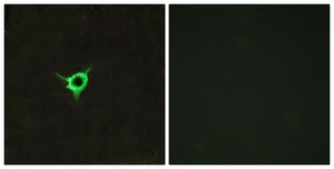Anti-CNR1 antibody produced in rabbit affinity isolated antibody