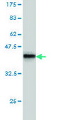 Monoclonal Anti-ROCK1 antibody produced in mouse clone 2E2, purified immunoglobulin, buffered aqueous solution