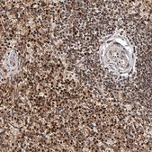 抗 BAX 兔抗 Prestige Antibodies® Powered by Atlas Antibodies, affinity isolated antibody, buffered aqueous glycerol solution