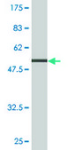 Monoclonal Anti-TPM3 antibody produced in mouse clone 2E4, purified immunoglobulin, buffered aqueous solution