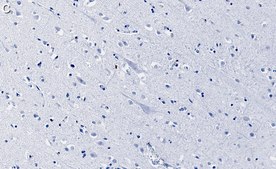 Anti-PKCα Antibody, clone 2H22 ZooMAb® Rabbit Monoclonal recombinant, expressed in HEK 293 cells