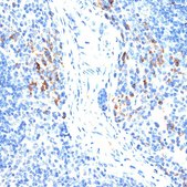 Anti-MMP9 antibody produced in rabbit