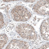 Anti-CDK20 antibody produced in rabbit Prestige Antibodies® Powered by Atlas Antibodies, affinity isolated antibody, buffered aqueous glycerol solution, ab2