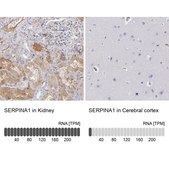 Anti-SERPINA1 antibody produced in rabbit Prestige Antibodies® Powered by Atlas Antibodies, affinity isolated antibody, buffered aqueous glycerol solution