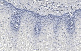 Anti-Rac1 Antibody, clone 1E9 ZooMAb® Rabbit Monoclonal recombinant, expressed in HEK 293 cells