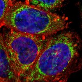 Anti-PHB antibody produced in rabbit Prestige Antibodies® Powered by Atlas Antibodies, affinity isolated antibody, buffered aqueous glycerol solution