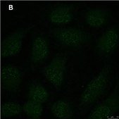 Anti-p-Ubiquitin (pSer65) Antibody, clone 2N21 ZooMAb® Rabbit Monoclonal recombinant, expressed in HEK 293 cells