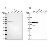 Anti-PAK4 antibody produced in rabbit Prestige Antibodies® Powered by Atlas Antibodies, affinity isolated antibody