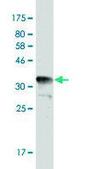 Monoclonal Anti-TYMS antibody produced in mouse clone 2B2, purified immunoglobulin, buffered aqueous solution