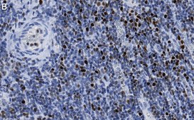 Anti-RUNX2 Antibody, clone 1D6 ZooMAb® Rabbit Monoclonal recombinant, expressed in HEK 293 cells