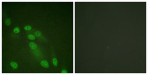 Anti-NF-κB p65 antibody produced in rabbit affinity isolated antibody