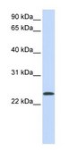 Anti-ARF1 antibody produced in rabbit affinity isolated antibody