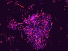 Akkermansia muciniphila FISH probe - Cy3 Probe for fluorescence in situ hybridization (FISH),20 μM in water