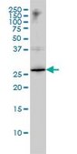 Monoclonal Anti-HMGB1 antibody produced in mouse clone 1D5, purified immunoglobulin, buffered aqueous solution