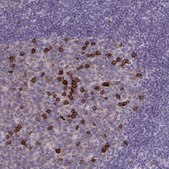 Anti-CD38 antibody produced in rabbit Prestige Antibodies® Powered by Atlas Antibodies, affinity isolated antibody, buffered aqueous glycerol solution