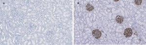 Anti-Nestin Antibody, clone 8B8, ZooMAb® Rabbit Monoclonal recombinant, expressed in HEK 293 cells