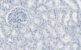 Anti-ROCK-1 Antibody, clone 3K23 ZooMAb® Rabbit Monoclonal recombinant, expressed in HEK 293 cells