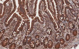 Anti-AMPK alpha Antibody, clone 2D22, ZooMAb® Rabbit Monoclonal recombinant, expressed in HEK 293 cells