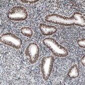 Monoclonal Anti-SETD2 antibody produced in mouse Prestige Antibodies® Powered by Atlas Antibodies, clone CL9956, purified immunoglobulin, buffered aqueous glycerol solution