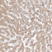 Anti-CPT2 antibody produced in rabbit Prestige Antibodies® Powered by Atlas Antibodies, affinity isolated antibody, buffered aqueous glycerol solution, ab3