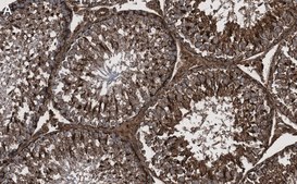 Anti-Actin Antibody, clone C4 ZooMAb® Mouse Monoclonal recombinant, expressed in HEK 293 cells