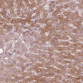 Anti-ACACB antibody produced in rabbit Prestige Antibodies® Powered by Atlas Antibodies, affinity isolated antibody, buffered aqueous glycerol solution