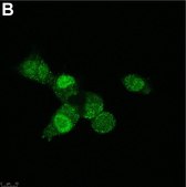 Anti-SNAI1 Antibody, clone 1F16 ZooMAb® Rabbit Monoclonal recombinant, expressed in HEK 293 cells
