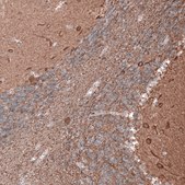 Monoclonal Anti-TUBB3 antibody produced in mouse Prestige Antibodies® Powered by Atlas Antibodies, clone CL5814, purified immunoglobulin, buffered aqueous glycerol solution