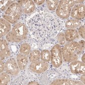 Anti-FABP1 antibody produced in rabbit Prestige Antibodies® Powered by Atlas Antibodies, affinity isolated antibody, buffered aqueous glycerol solution