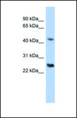 Anti-RYBP antibody produced in rabbit affinity isolated antibody