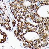 Anti-HSPA4 antibody produced in rabbit
