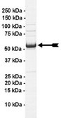 p53 Protein, 10 µg Full length, recombinant human p53. N-terminal c-Myc, 6His-tagged. For use in Enzyme Assays. Functions as a substrate in ubiquitination assays.