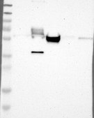 Anti-MAP2 antibody produced in rabbit Prestige Antibodies® Powered by Atlas Antibodies, affinity isolated antibody, buffered aqueous glycerol solution
