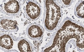 抗-GAPDH抗体，克隆10B13，ZooMAb®兔单克隆抗体 recombinant, expressed in HEK 293 cells