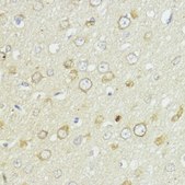 Anti-BCL2 antibody produced in rabbit