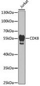 Anti-CDK8 antibody produced in rabbit