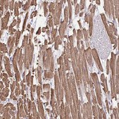 Anti-MYL2 antibody produced in rabbit Prestige Antibodies® Powered by Atlas Antibodies, affinity isolated antibody, buffered aqueous glycerol solution