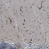 抗-P2RY12 兔抗 Prestige Antibodies® Powered by Atlas Antibodies, affinity isolated antibody, buffered aqueous glycerol solution